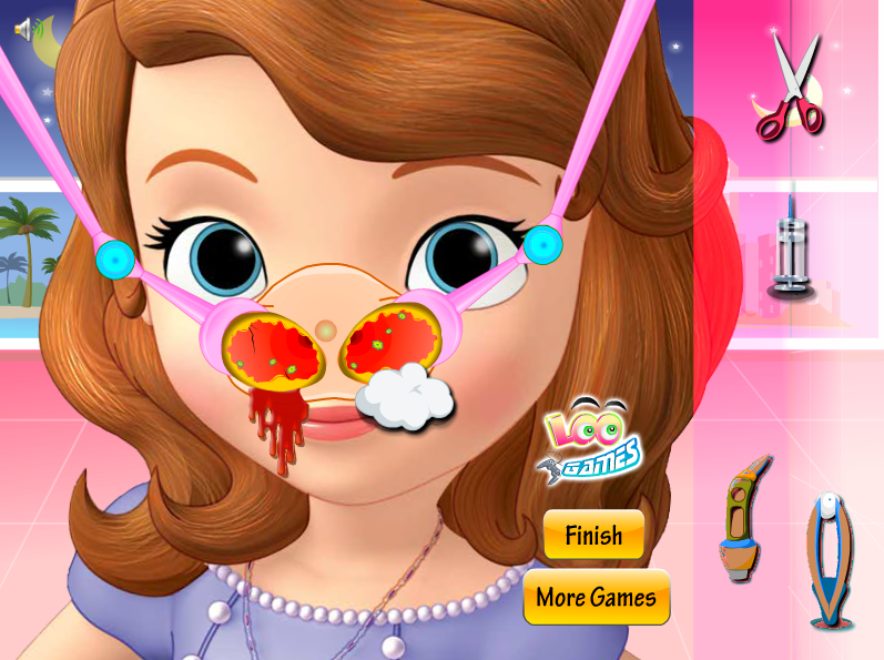 Sofia Nose Intervention