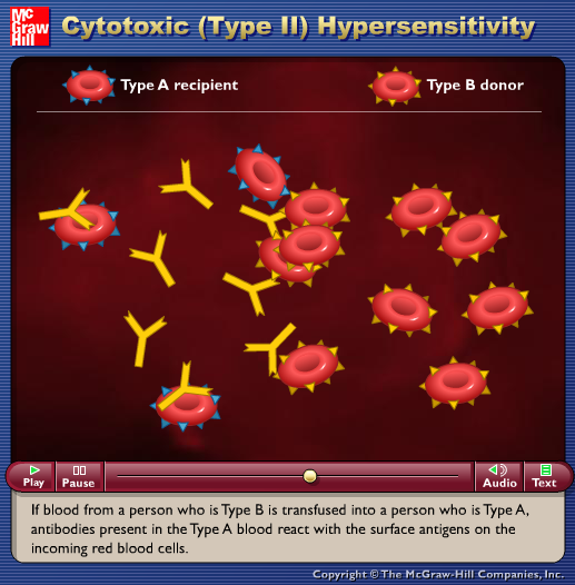 Cytotoxic (Type II) Hypersensitivity