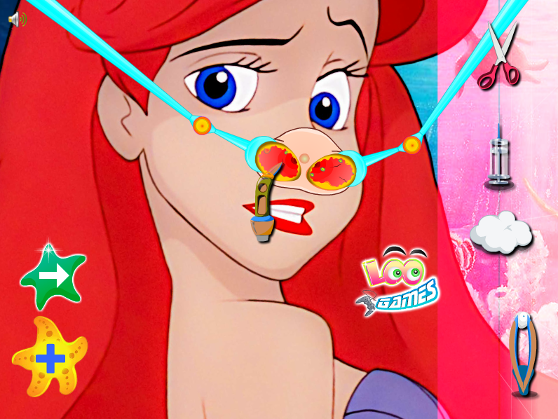 Ariel Nose Intervention
