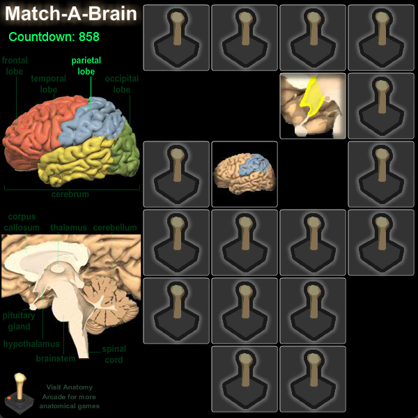 Match-A-Brain