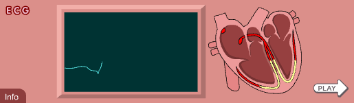 Banner for Electrocardiogram - ECG