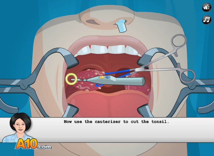 Operate Now! Tonsil Surgery