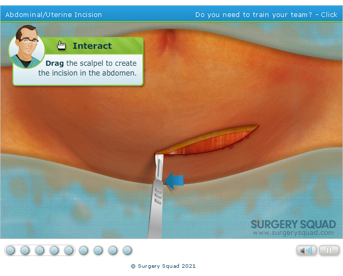 Surgery Squad: Virtual Cesarean Section