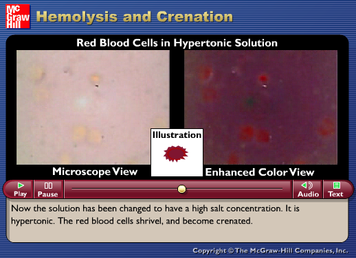 Hemolysis and Crenation