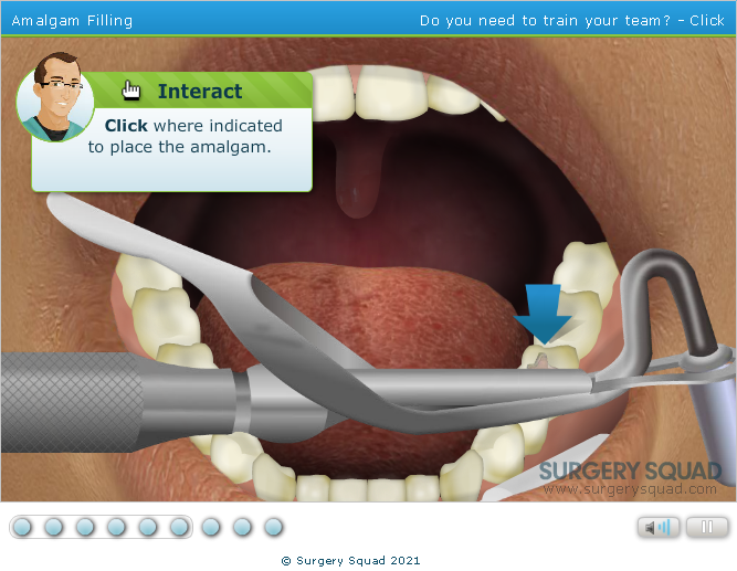 Surgery Squad: Virtual Dental Filling Placement