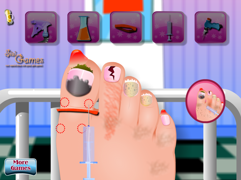 Nail Surgery Foot Spa