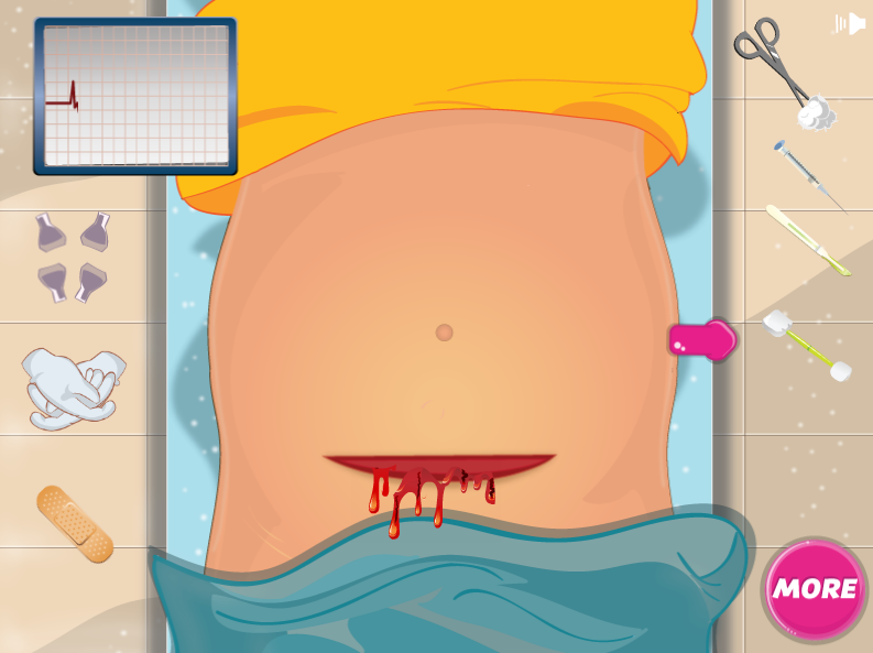 Princess Sofia Cesarean Birth