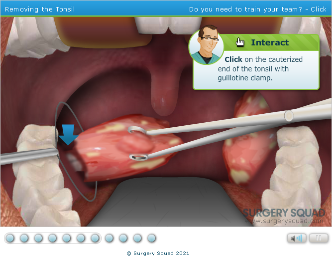 Surgery Squad: Virtual Tonsillectomy Surgery