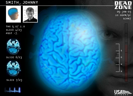 The Dead Zone: Touch Johnny's Brain