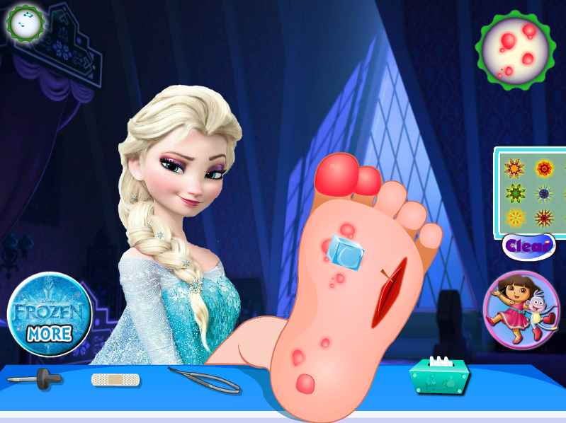 Frozen Foot Surgery