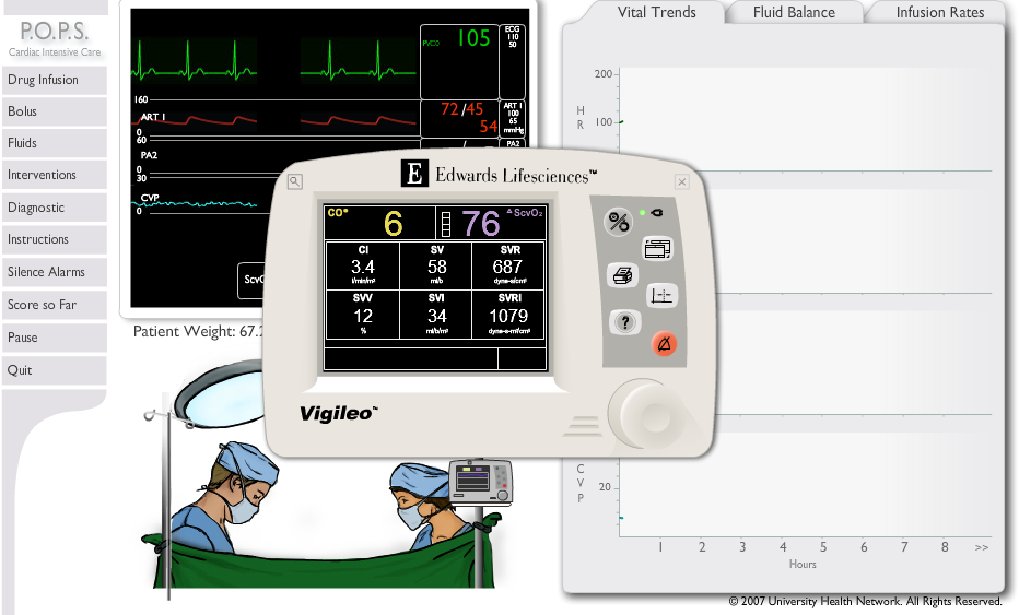 Peri-Operative Patient Simulation (P. O. P. S) - Intraoperative Patient Simulation - Vigileo Version 7 Surgical