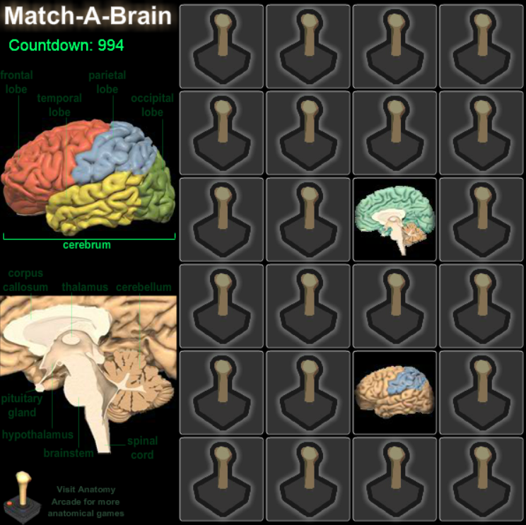 Match-A-Brain