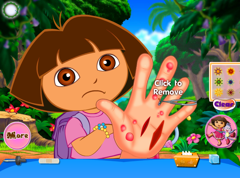 Dora Hand Injuries