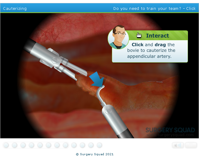Surgery Squad: Laparoscopic Appendectomy