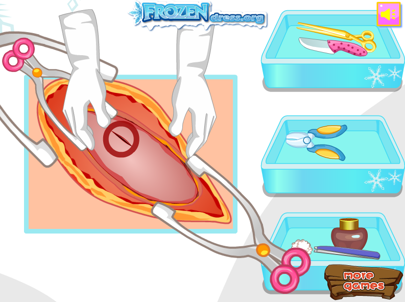 Elsa Appendicitis Operation