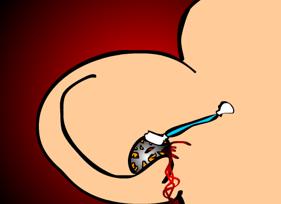 Explosion of Earwax