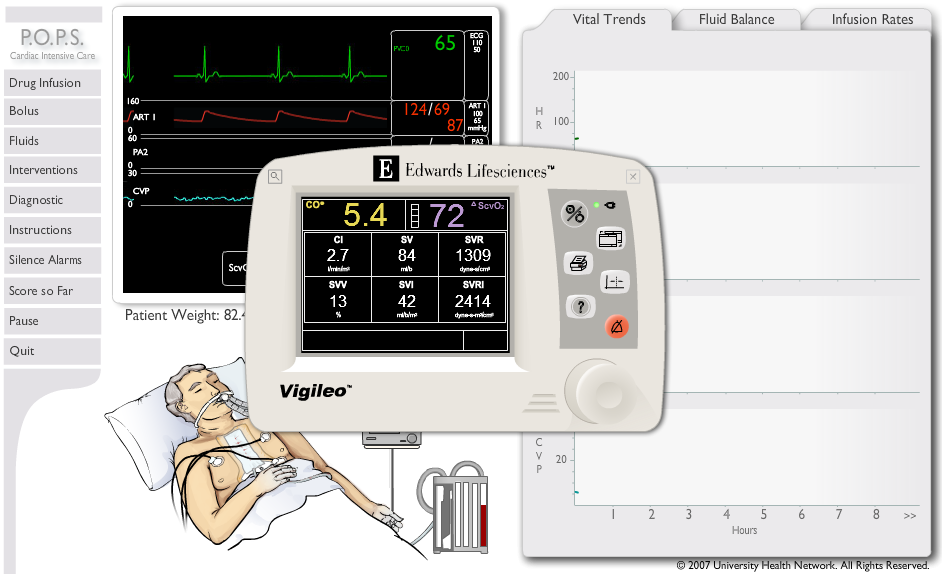 Peri-Operative Patient Simulation (P. O. P. S.) - Cardiac Intensive Care Simulation - Vigileo Version 7 Post-Operative