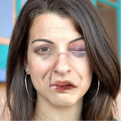 Beat Up Anita Sarkeesian