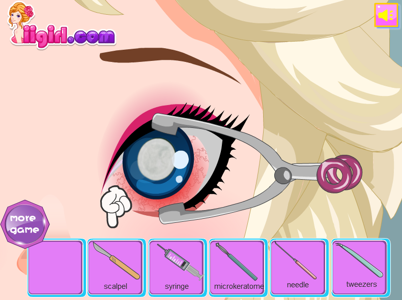 Elsa Eye Surgery