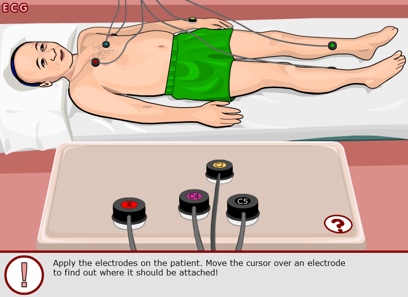 Electrocardiogram - ECG