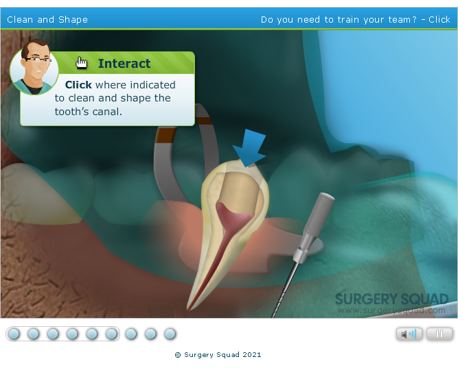 Surgery Squad: Virtual Root Canal Procedure